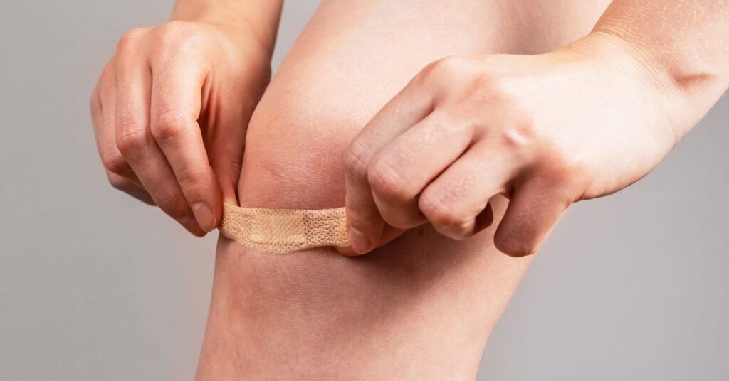 Turkey Tail Extract and Its Role in Supporting Wound Healing