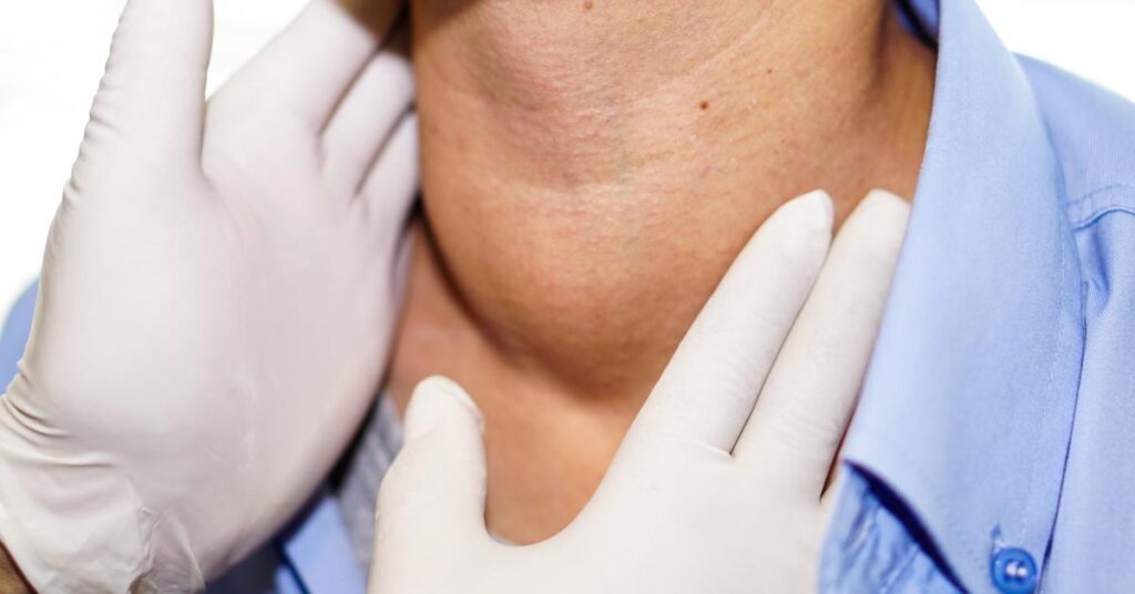 Radioactive Iodine Treatment for Hyperthyroidism 1 Radioactive Iodine Treatment for Hyperthyroidism 1