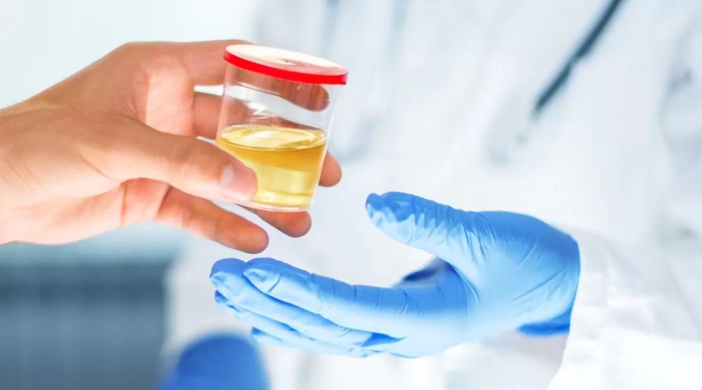 Will Cordyceps Extract Negatively Affect A Drug Test